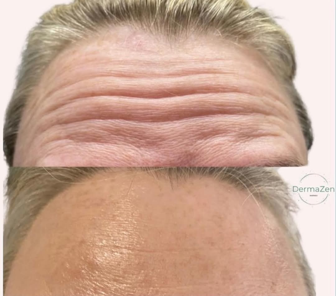 Skincare Results
