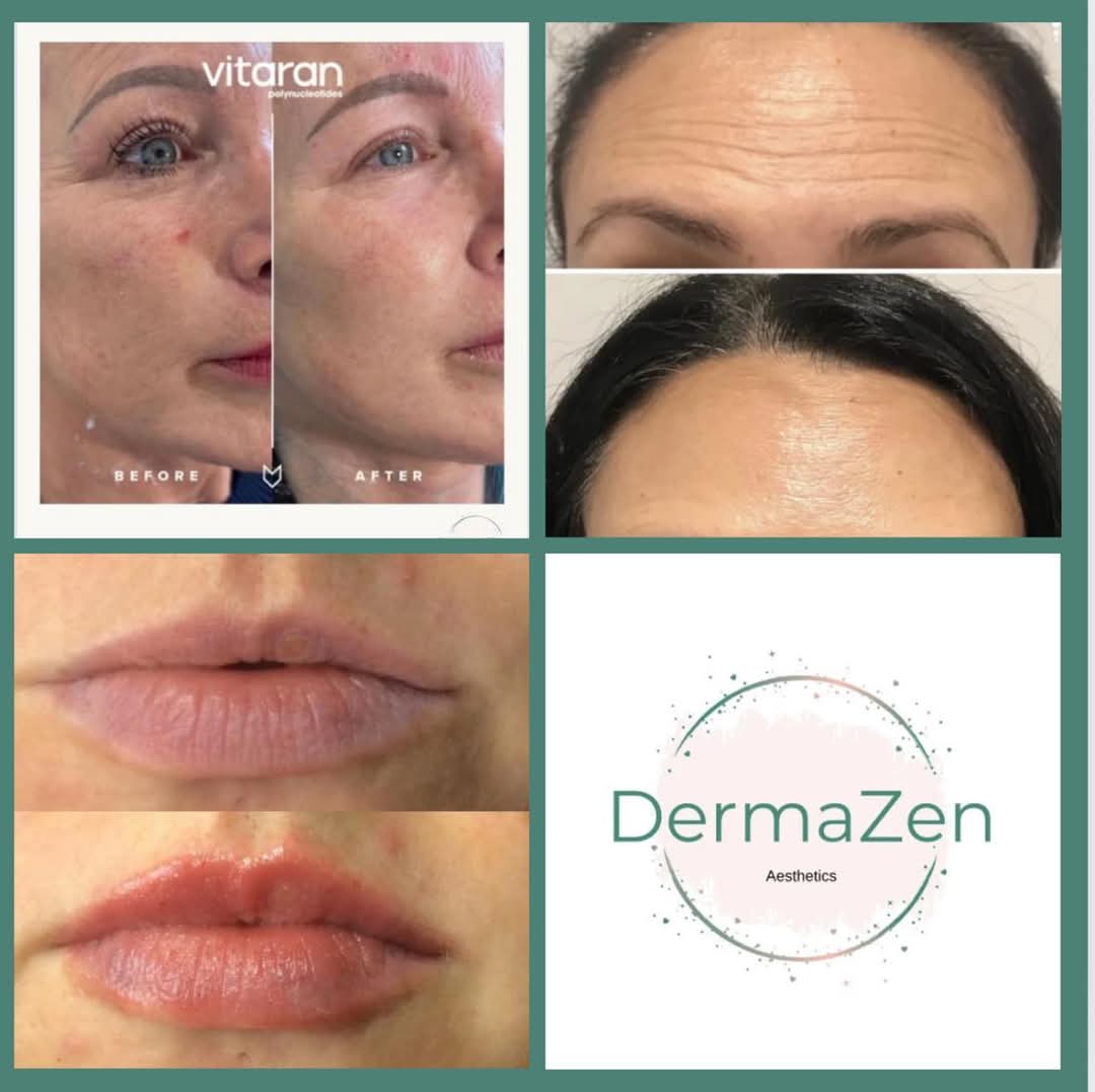 Skincare Results