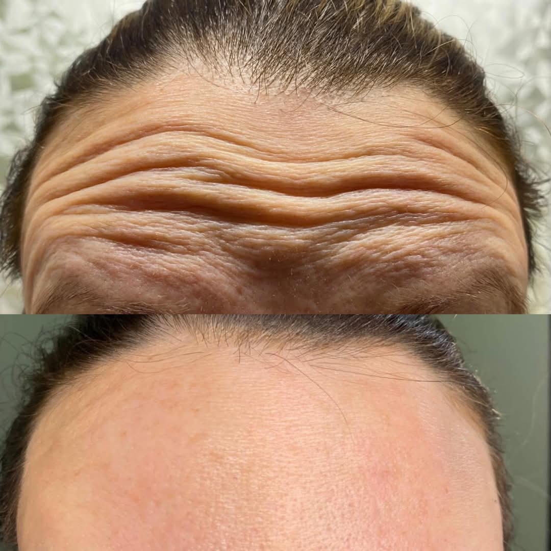 Skincare Results
