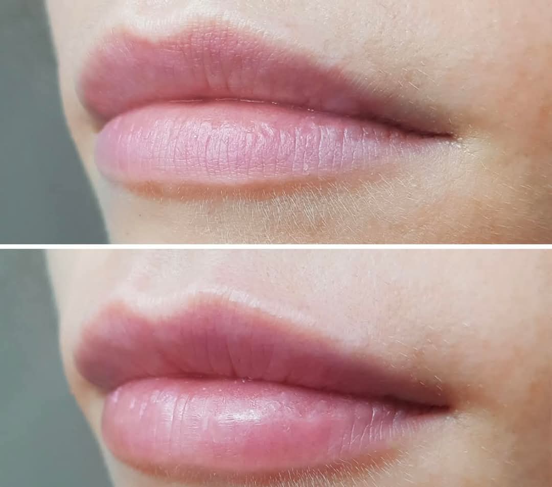 Skincare Results